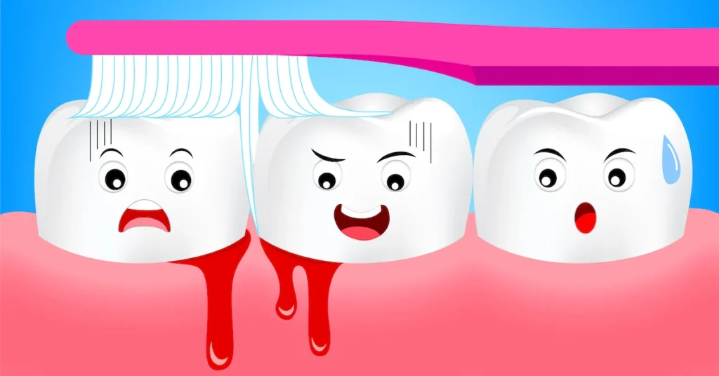 Is Bleeding Gums an Early Sign of Gum Disease Nottingham?