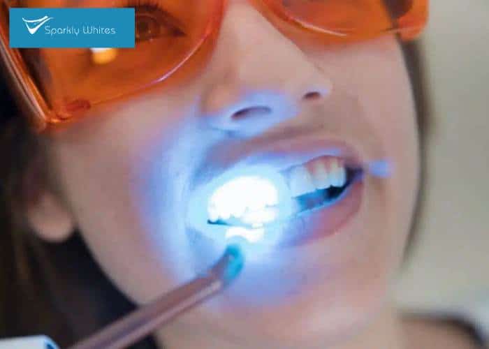 Is One Whitening Method Safer for Crowns, Fillings, or Dental Work Nottingham?